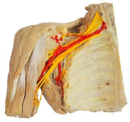 Axillary Artery And Its Branches Plasticized Human Body