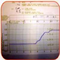 METEOROLOGICAL CHARTS