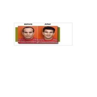 Hair Loss Treatment
