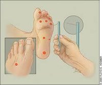 Monofilaments Diabetes