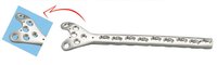 Locking Condylar Buttress Plate for 5.0 And 6.5 mm Screws