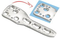 Locking Proximal Humerus Plate for 3.5 mm Screws