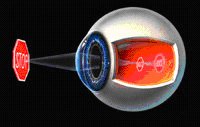 Eye Care Service