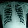 Inkjet Printing Blue X-Ray Film