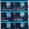 Inkjet Printing White Ultrasound X-Ray Film