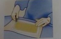Dressing Pre OP Adhesive Drape