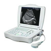 Digital Ultrasound Scanner