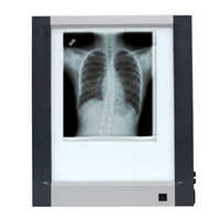 X ray viewer