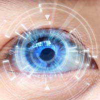 Cataract surgery