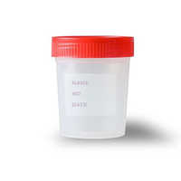 Urine collection container