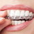 Dental Braces