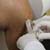 Knee Injections
