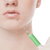Botox Injection